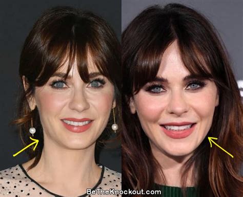 zooey deschanel facelift|Zooey Deschanel Plastic Surgery Before and After。